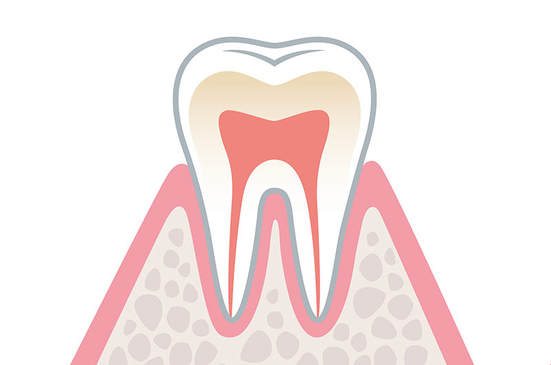 健康な歯（進行度0）